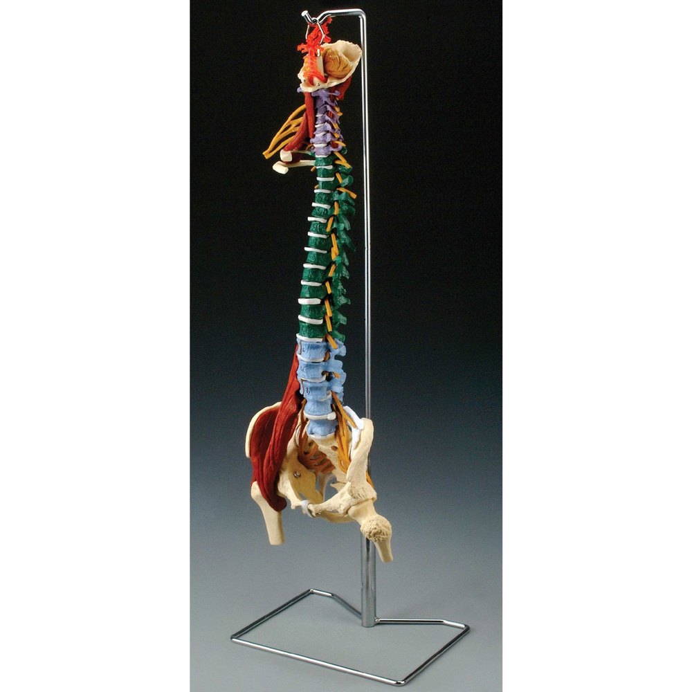 Life Size Spine with Muscles and Disorders