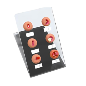 Cervical Lesion Model
