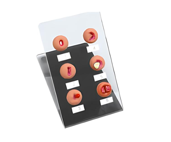 Cervical Lesion Model Cervical Lesion Model