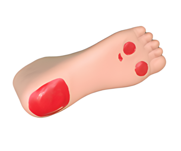 DIABETIC Foot Nursing Simulator