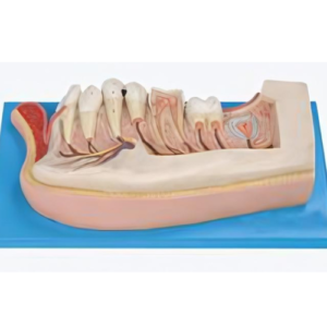 This model shows the shape and conformation of the sets of permanent teeth of child (11- 14 years old), as well as the structure of the decayed teeth. 21 positions are displayed.