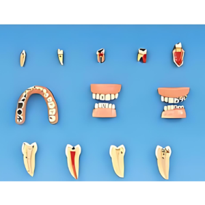 Dental Diseases Model