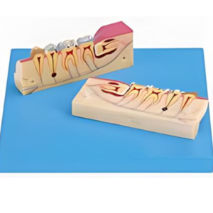 Dissected Model of Teeth Tissue