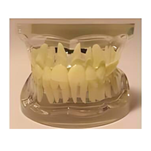 Transparent Adult Teeth Model