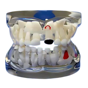 Transparent Milk Teeth Pathology Model